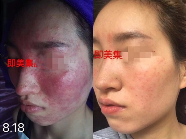 春季防敏，你需要補(bǔ)課的小訣竅！