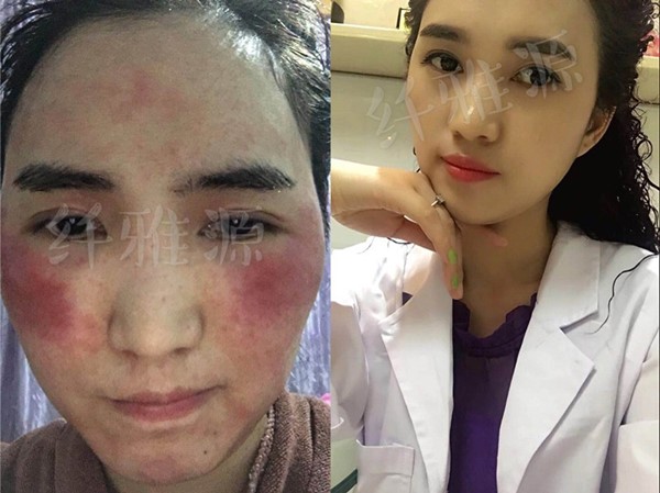 春季防敏，你需要補(bǔ)課的小訣竅！