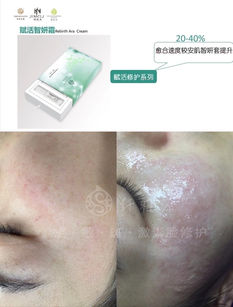 新年新品丨王牌技術再升級,祛斑更簡單了。 新年新品丨王牌技術再升級,祛斑更簡單了。