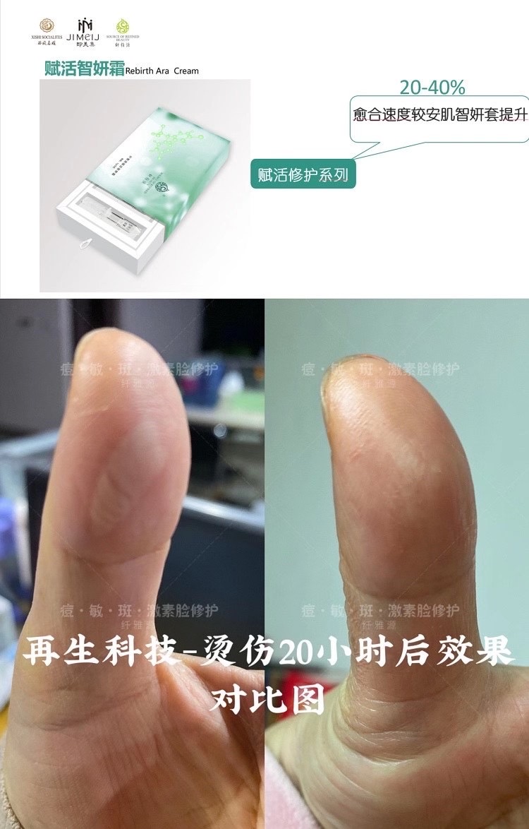 新年新品丨王牌技術再升級,祛斑更簡單了。 新年新品丨王牌技術再升級,祛斑更簡單了。