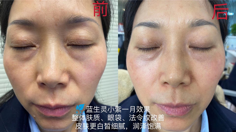 一篇大實(shí)話丨讀懂年輕五歲，速來圍觀