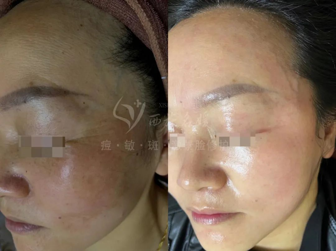 爆品丨西施名媛玫瑰、纖雅源白及植萃套