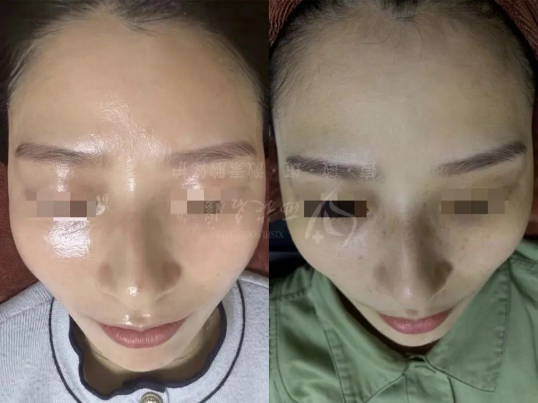 爆品丨西施名媛玫瑰、纖雅源白及植萃套