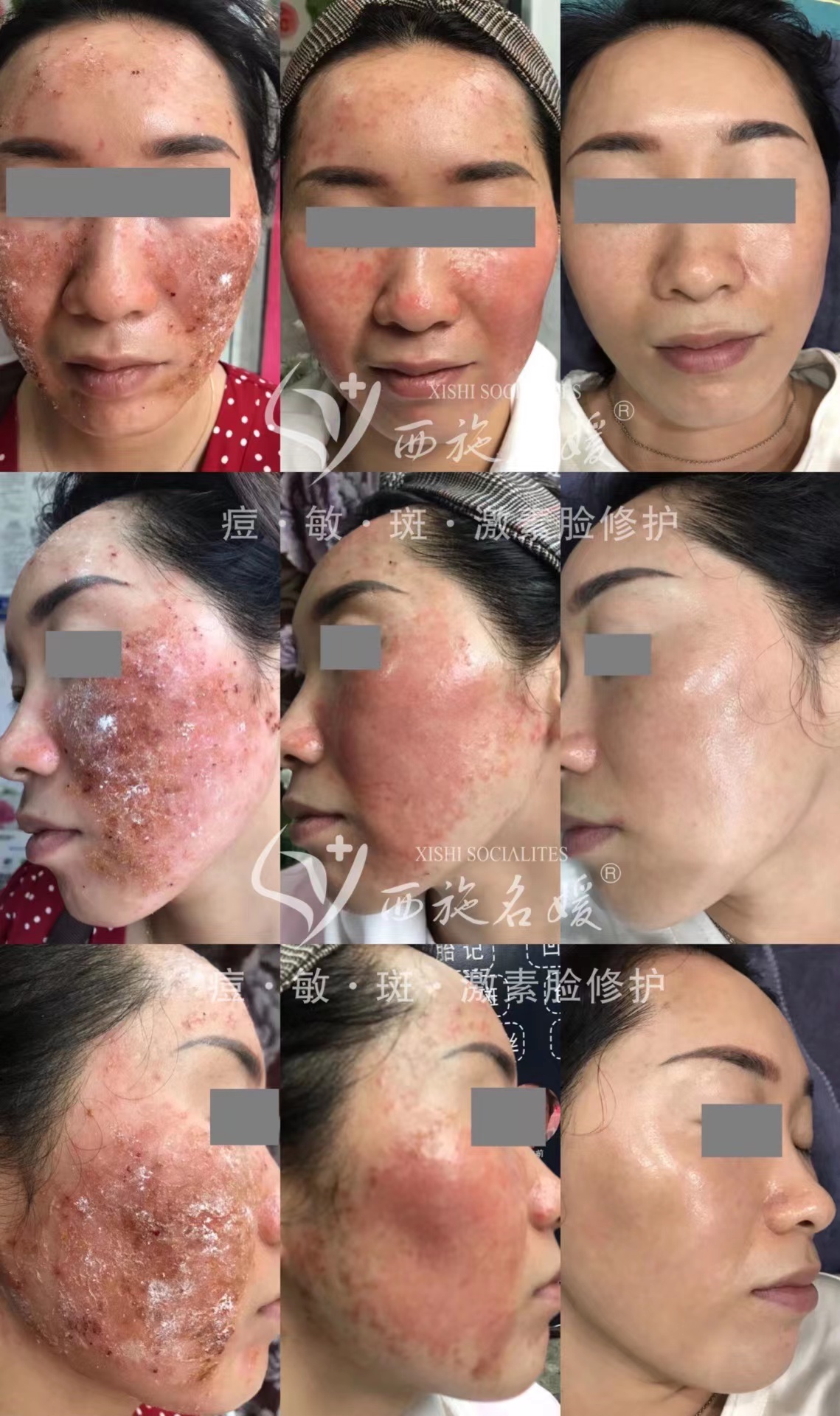 爆品丨西施名媛藍(lán)銅肽安膚套、纖雅源積雪草舒潤套