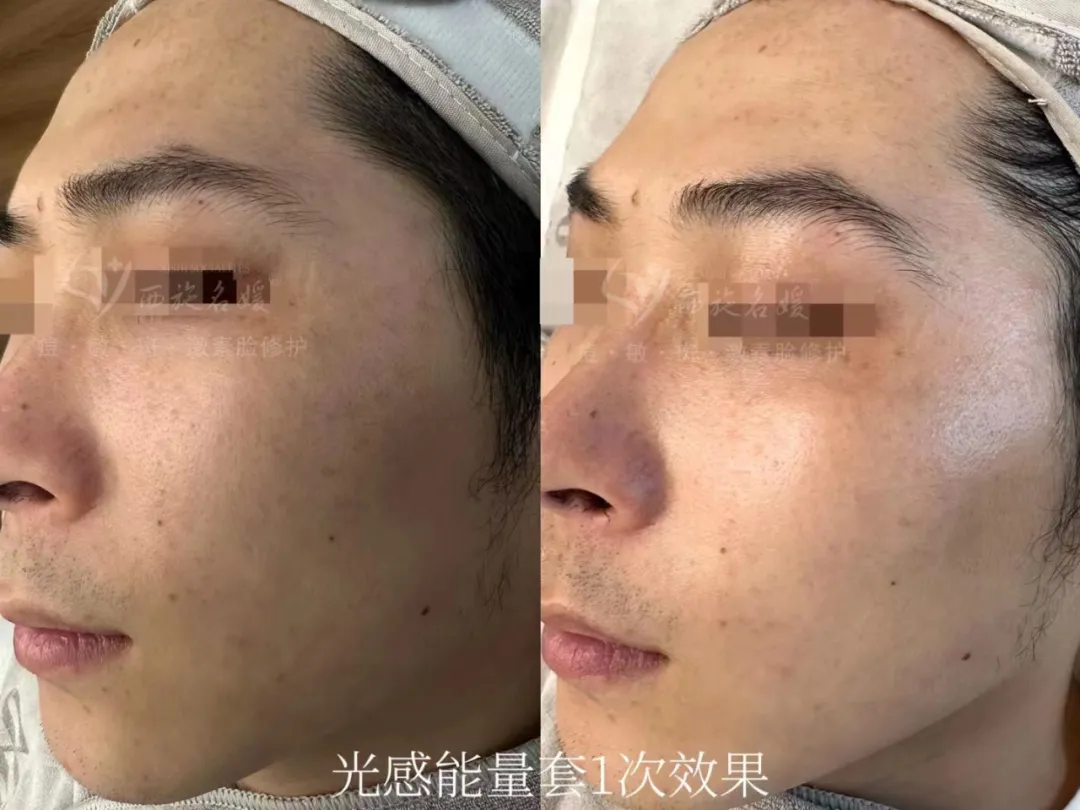 新品速遞丨拓客王者，升級回歸